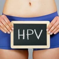 Kondilomi - 1776814664